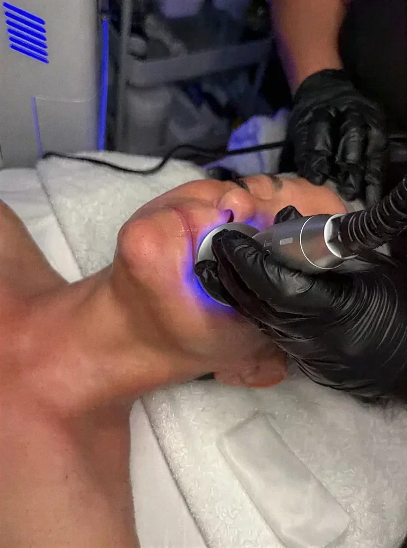 Advanced Skin
