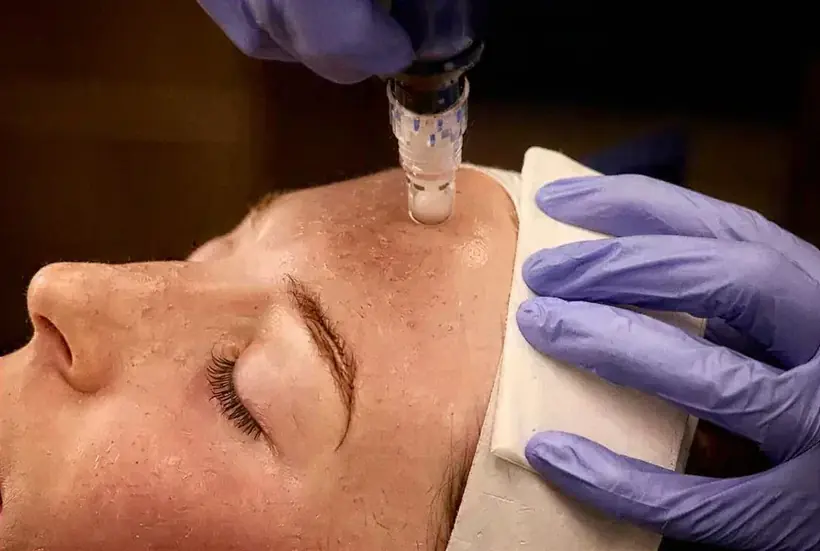 Hydra Lift Skin Rejuvenation